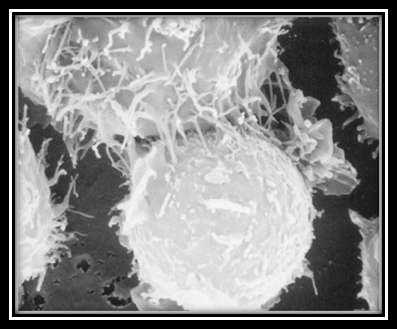 免疫细胞粘附到癌细胞细胞膜上	