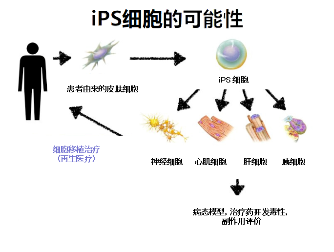 iPS细胞的可能性